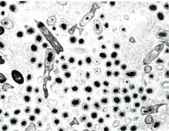 anthrax spores