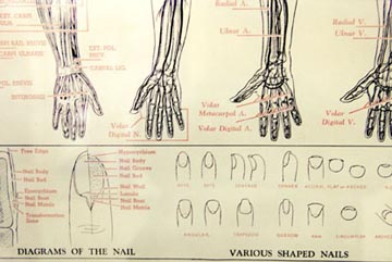 000428.diagramnail